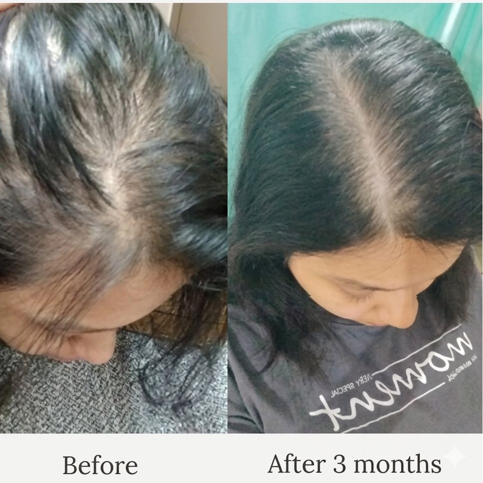 Aurlix™ Plant-powered Hair Oil Serum